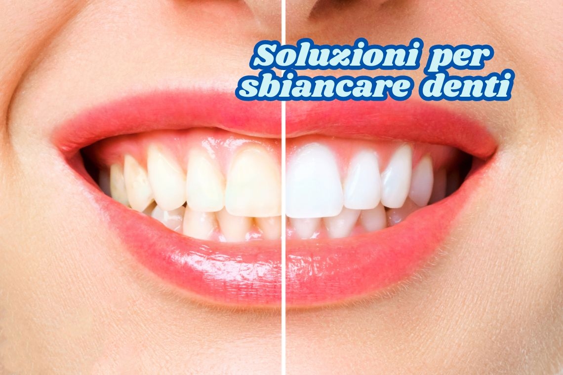 Soluzioni per Denti Scoloriti o Giallastri: I Migliori Prodotti Online